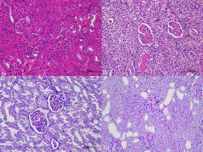 Diffusion Tensor Imaging in Rat Models of Preclinical Diabetic Nephropathy: A Preliminary Study